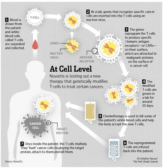 CAR-T의 제조 및 투여 과정