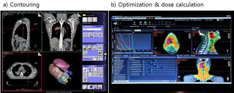 Contouring, optimization and dose calculation in the treatment planning system for carbon therapy