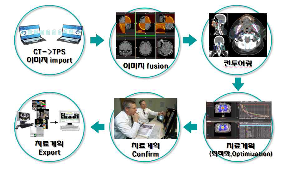 The overall process of radiation treatment planning