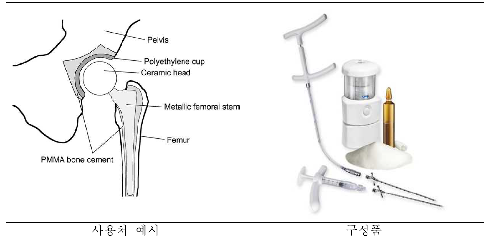 골시멘트 사용처 및 구성품 예시