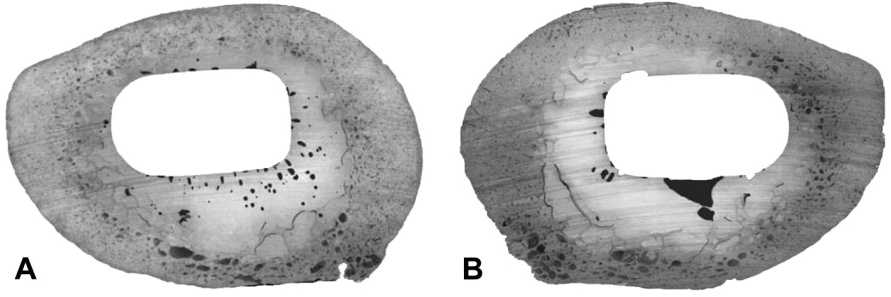 Representative sections illustrating the distribution of porosity for A. hand-mixing and B. Vacuum mixing