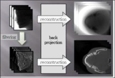 Back Projection과 Filtered Back Projection 비교