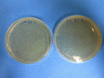 종이 멸균 후 배양액 도말, 좌 : A멸균기 , 우 : B멸균기