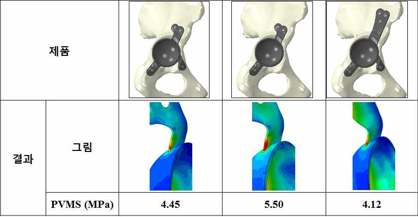 맞춤형 인공엉덩이관절의 유한요소 비교 결과 (임플란트)