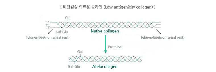 Matrixen® 관련 비항원성 의료용 콜라겐
