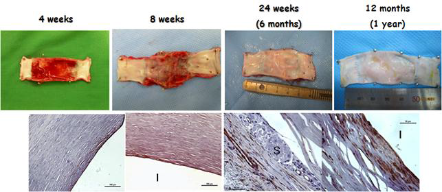 인공혈관의 장기 개통능 및 자가 혈관 대체 능력 확인. 위: 4주, 8주, 6개월 그리고 1년간의 개통능 확인, 아래: 혈관내피세포 염색을 통한 인공혈관의 혈관 세포의 침투 능력 검증
