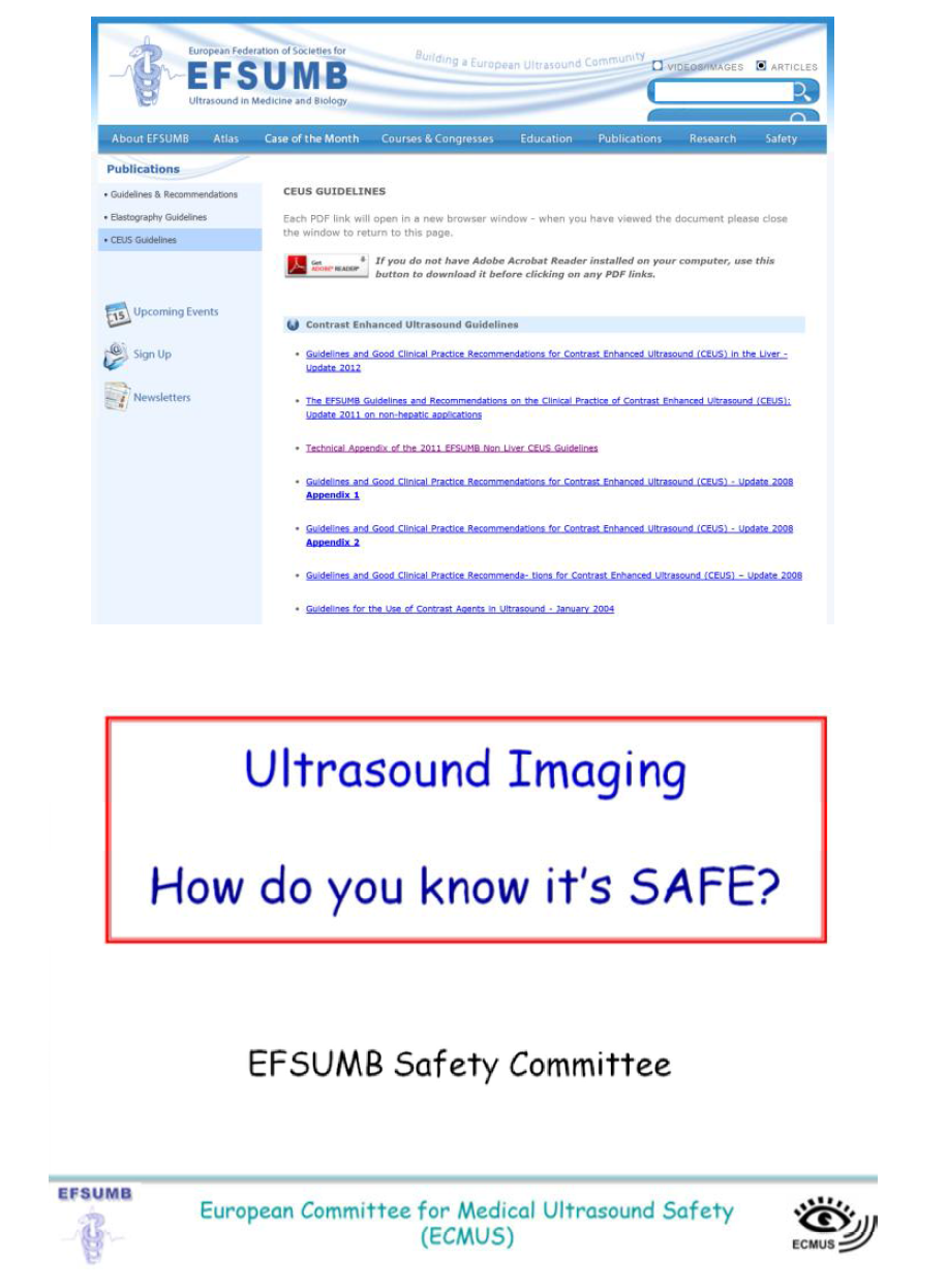 조영초음파 혈류측정기기 관련 EFSUMB Safety Statements 등 조사 및 분석