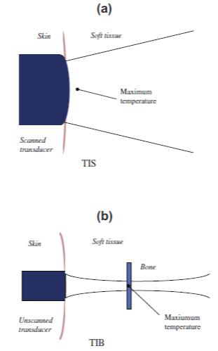 (a) 연조직 열지수(TIS) 와 (b) 초점에서의 뼈 열지수(TIB) 계산에 사용되는 단순 모델