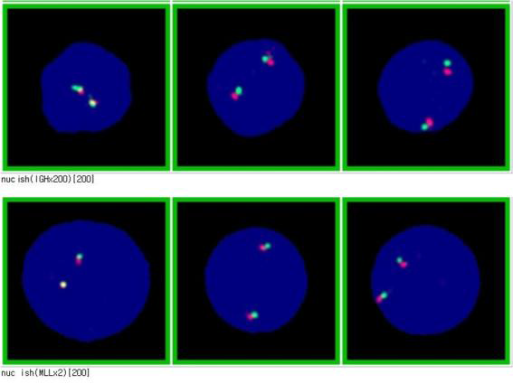 분열간기세포 분석의 시행 및 세포 신호 수 계측 예
