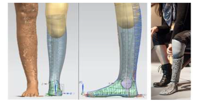 의족의 3D 형상과 착용 모습