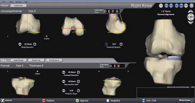 Materialise 소프트웨어