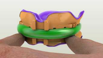 Dentca Denture Base