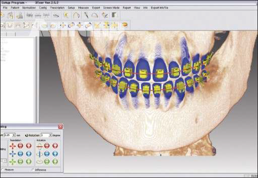 Orapix Jig System