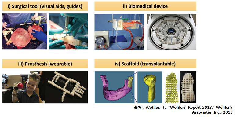 3D 프린팅 의료기기의 적용분야