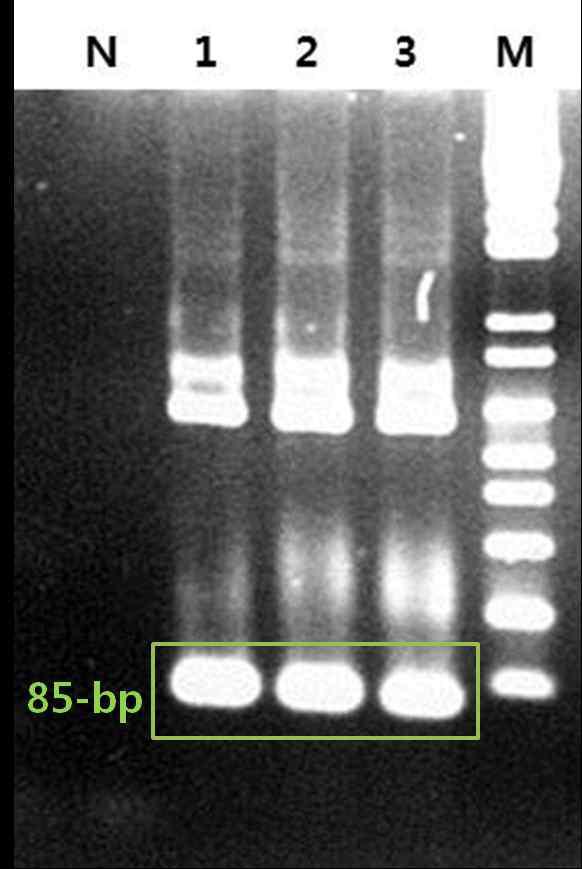 프라이머를 이용한 증폭산물의 확인