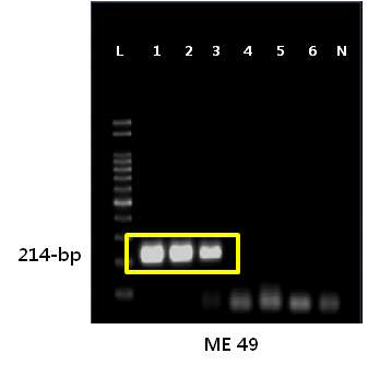 톡소포자충 type 2 ME49 strain의 민감도 확인 결과