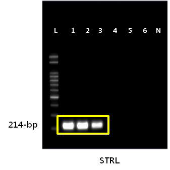 톡소포자충 type 3 STRL strain의 민감도 확인 결과