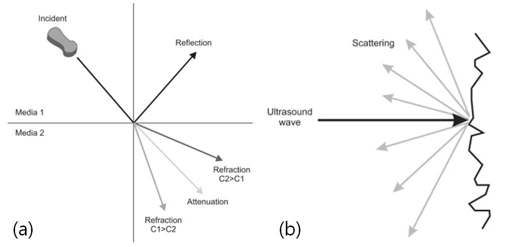 (a) 초음파의 반사(Reflection), 굴절(Refraction) 및 감쇠(Attenuation), (b) 초음파의 산란(Scattering) 형태