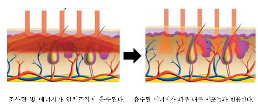 광선 조사 시 내부 변화