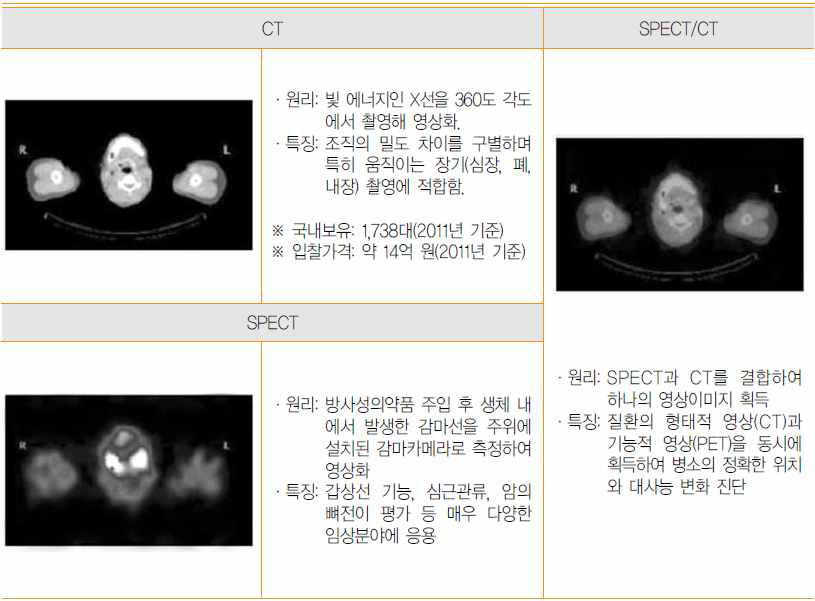 CT, SPECT 및 SPECT/CT의 비교