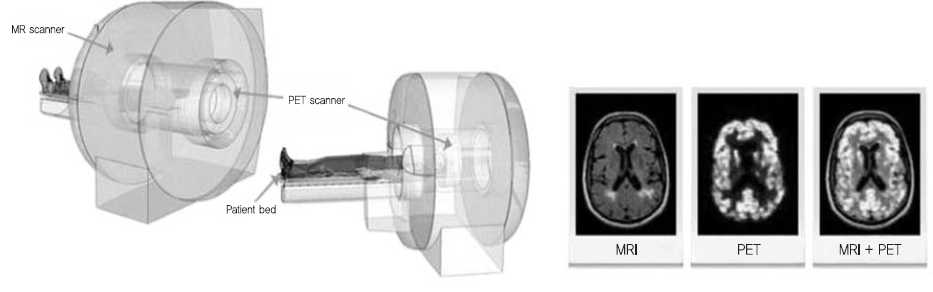 PET/MRI 장비 및 촬영이미지