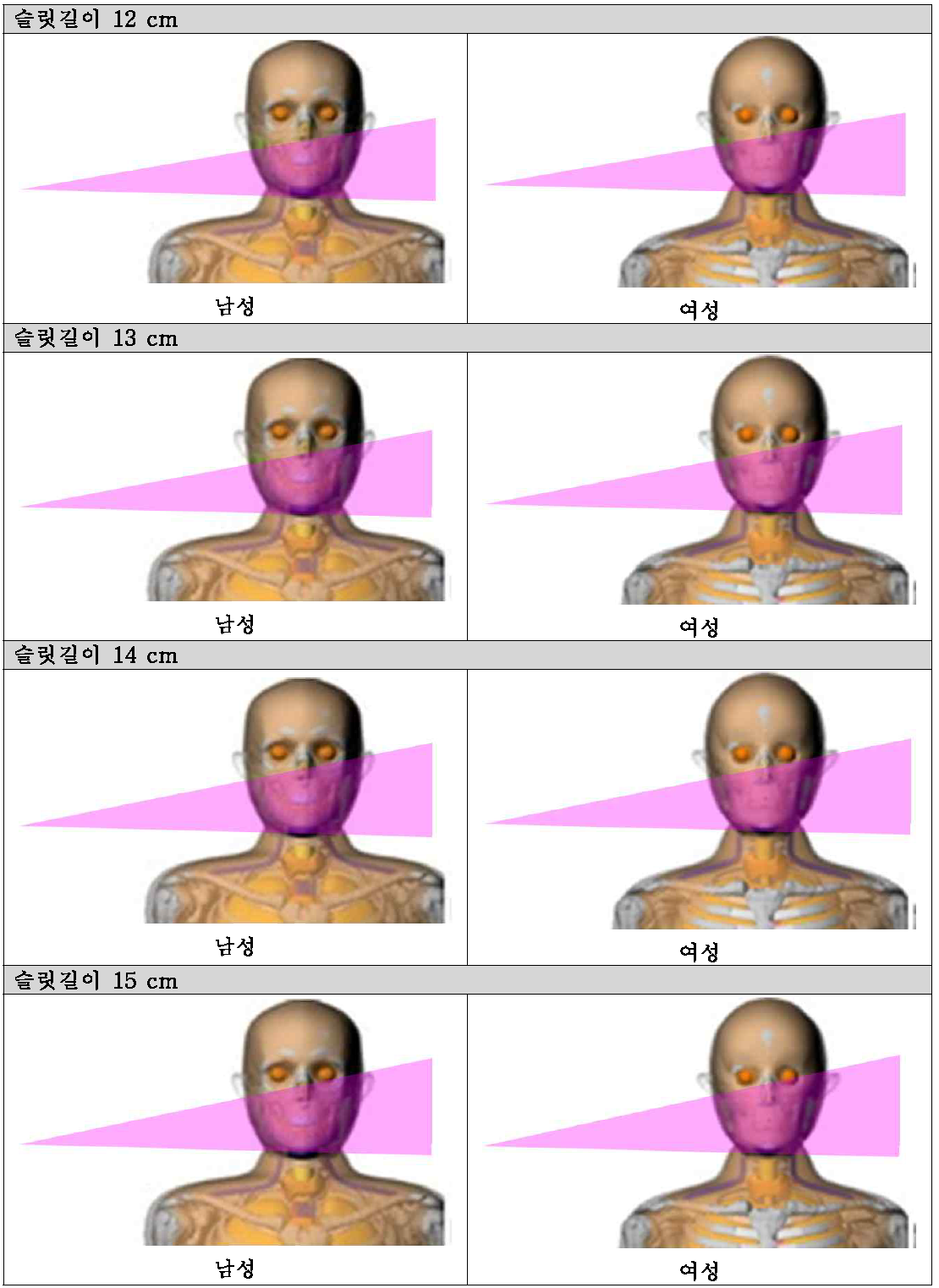 파노라마 검사 시 슬릿길이에 따른 검사범위 종류