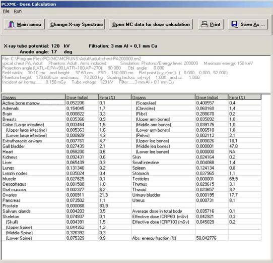 PCXMC의 환자선량 계산 결과 화면