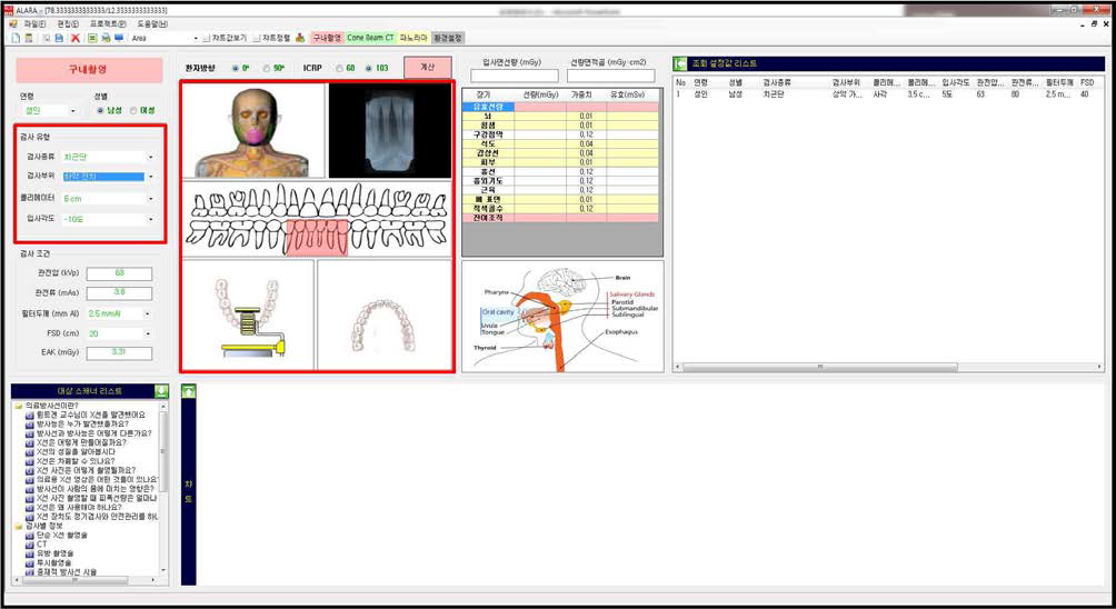 선량계산 프로그램 내 검사범위의 선정
