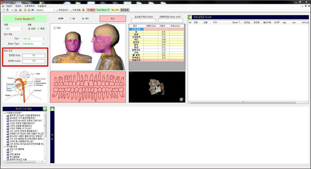 검사조건의 입력 (치과용 CT)