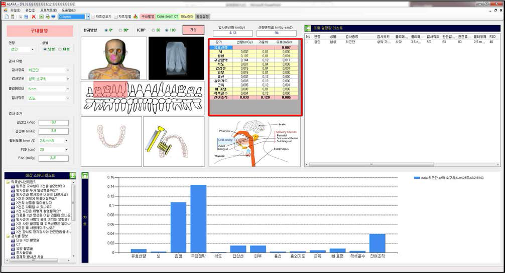 구내방사선검사 시 장기선량 및 유효선량 확인