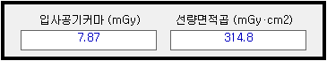 CBCT 검사 시 방사선량 지표 결과 확인창