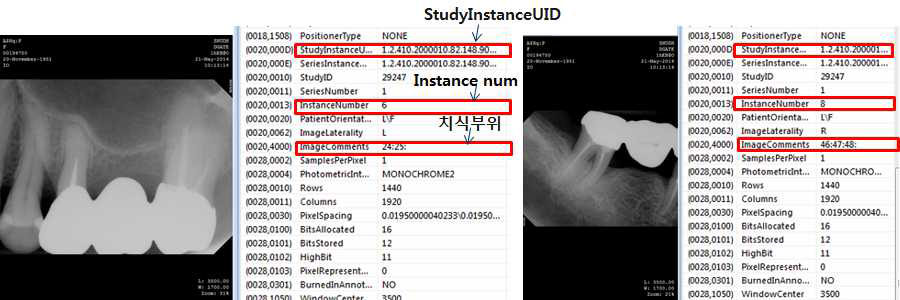 구내방사선검사의 Instance Number 확인