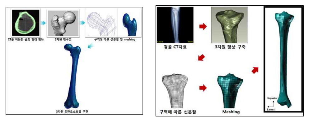 대퇴골 및 경골의 유한요소 모델 구축 과정