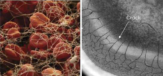 (좌) 응고 기작. Fibrin의 그물망 형성, (우) 증발 기작. 증발 시 crack이 형성 됨