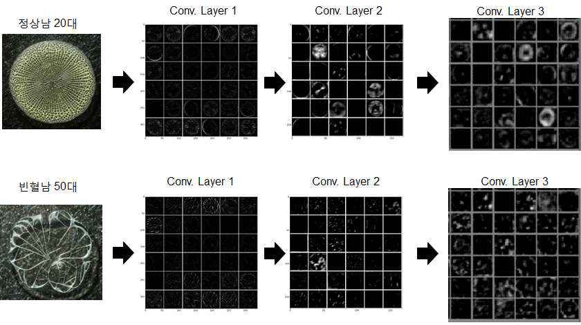 Convolutional Neural Network (CNN) 기법