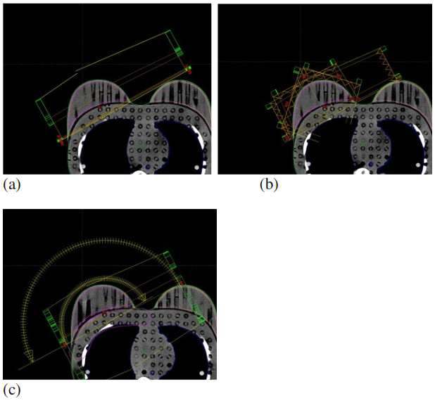 Axial field image for setup of (a) 3D-CRT, (b) IMRT, and (c) RapidArc