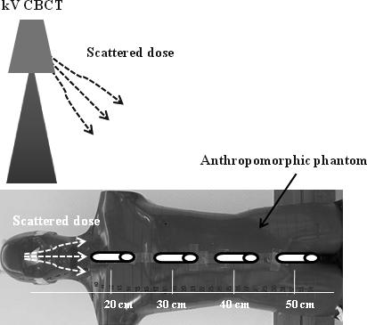 Schematic picture for measuring secondary doses in an anthropomorphic phantom during CBCT, located 20, 30, 40, and 50 cm from the beam isocenter.