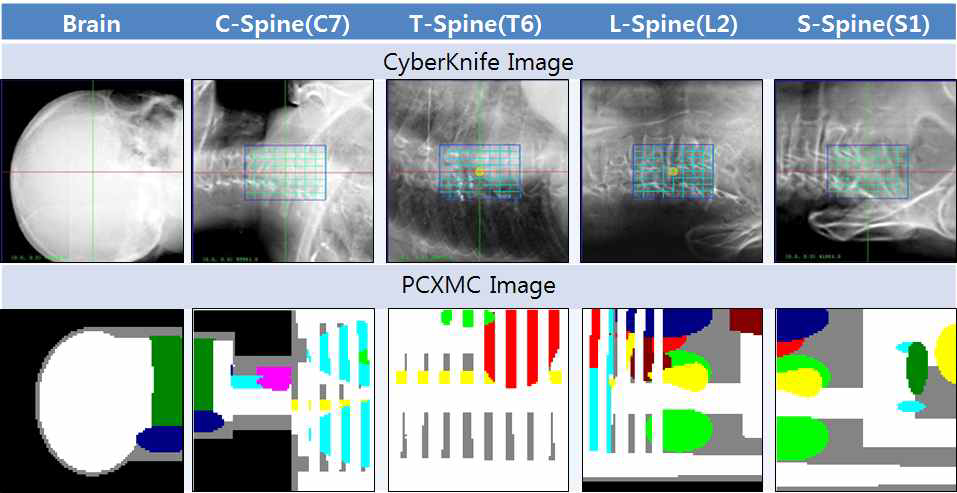 Live images and simulated images to calculate dose from X-rays for each treatment