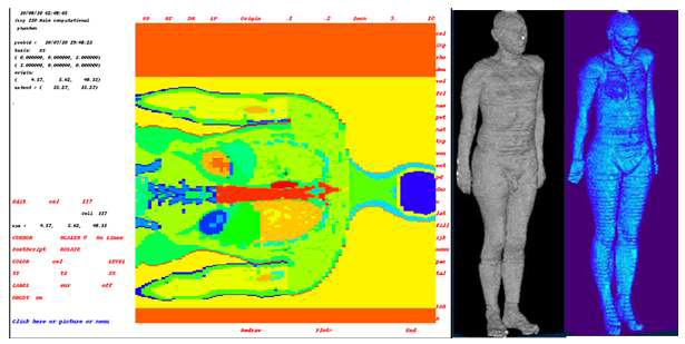 ICRP 110 보고서에서 제공하는 성인 남․여 팬텀 및 그 단면도
