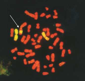 염색체 삽입이 관찰되는 분열중기 세포의 염색체 모습. 염색체 1번 쌍은 노란색으로 염색