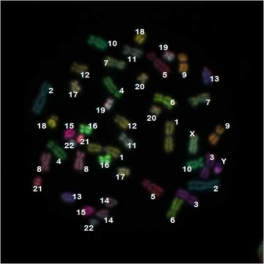 24 mFISH 분석법을 통해 관찰된 중기세포에서 각 염색체의 구별, 염색체 번호 표기