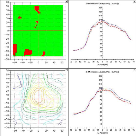 두경부암환자의 방사선치료 계획을 필름을 이용하여 검증한 결과. Gamma - index 3%- 3 mm로 분석한 결과 91.8%의 일치함을 나타내었다.