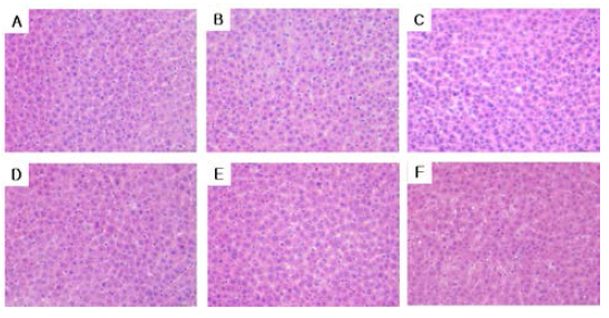 Liver tissue H & E staining of Pleuropterus multiflorus treated groups