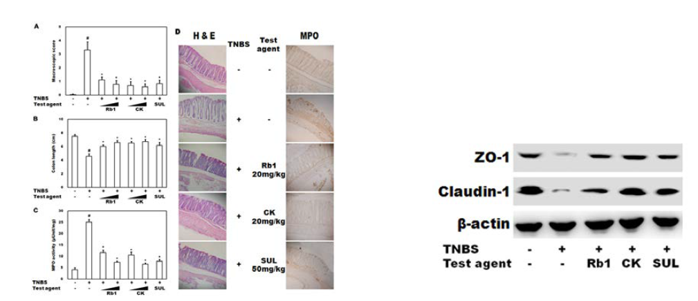 Inhibitory effects of ginsenosides in TNBS-induced colitic mice. Ginsenoside Rb1 (Rb1) and compound K (CK) (10 mg/kg or 20 mg/kg), sulfasalazine (SUL, 50 mg/kg), or saline was orally administered for 3 days after TNBS treatment. Mice were sacrificed 12 h after the final administration of test agents