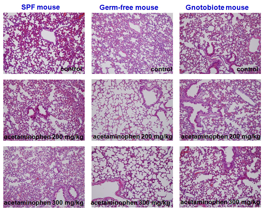 (Lung) Histologic diagnosis after oral administration of acetaminophen in germ-free, gnotobiote and SPF mice. Each tissue doesn