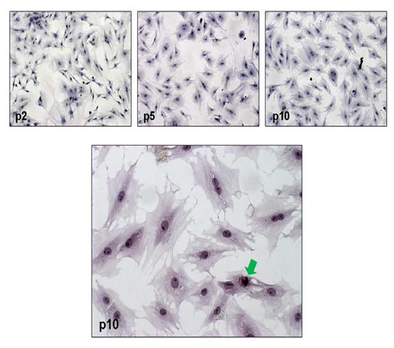 계대배양에 따른 줄기세포 사멸 유전자 발현 (protein)