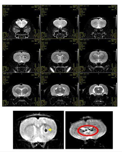 뇌졸중 동물모델에서 peridex를 이용한 세포 생착 및 이동 (MRI system)