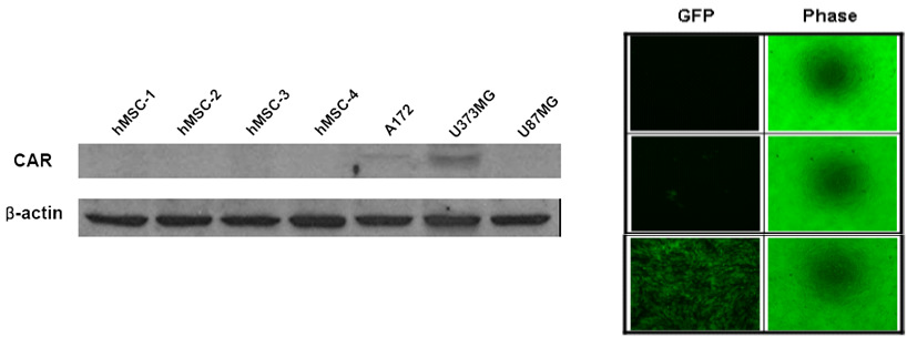 중간엽줄기세포에서 CAR expression 및 GFP 발현 확인