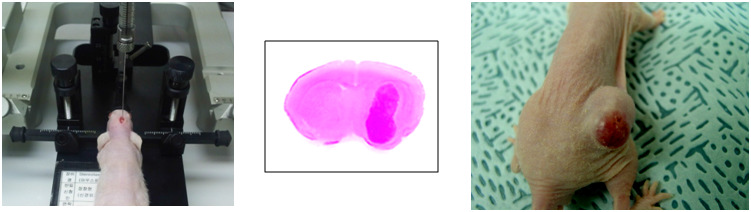 Intracranial tumor model (좌) 및 subcutaneous tumor model (우) 확립