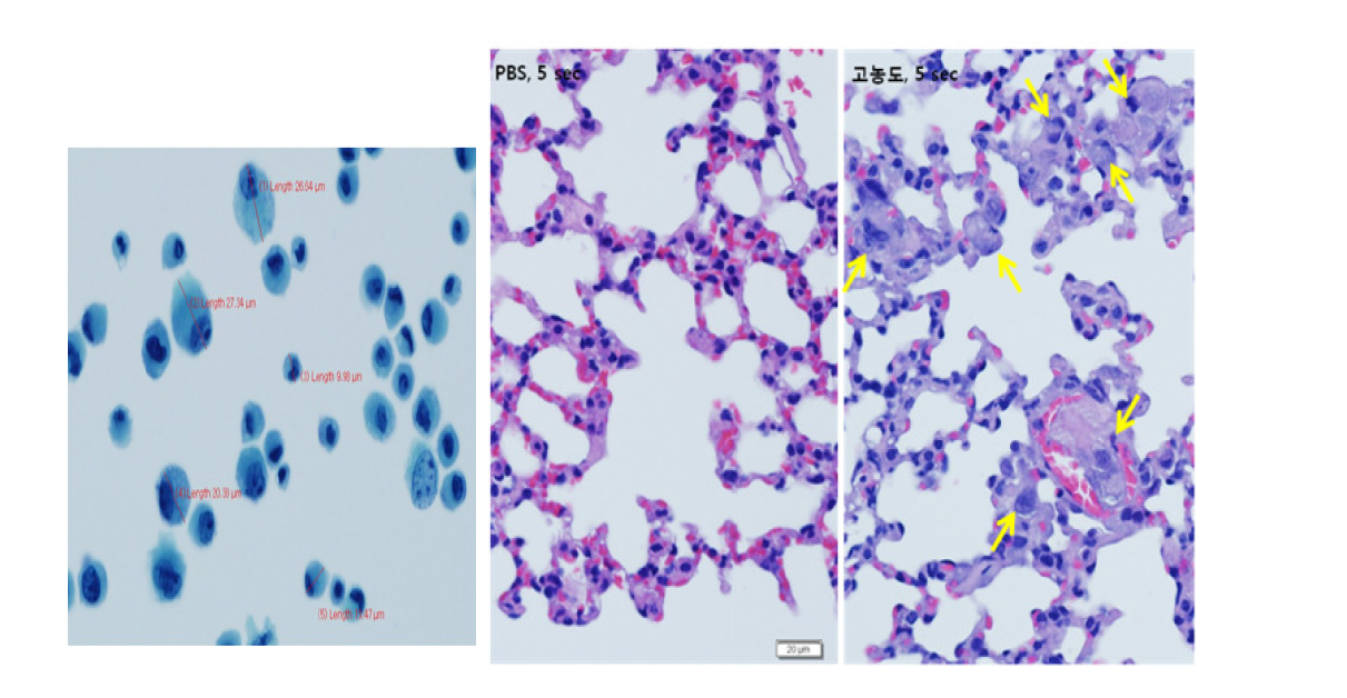 Hematoxylin & Eosin (H&E) staining of lung tissues in mouse mesenchymal stem cells injected mice